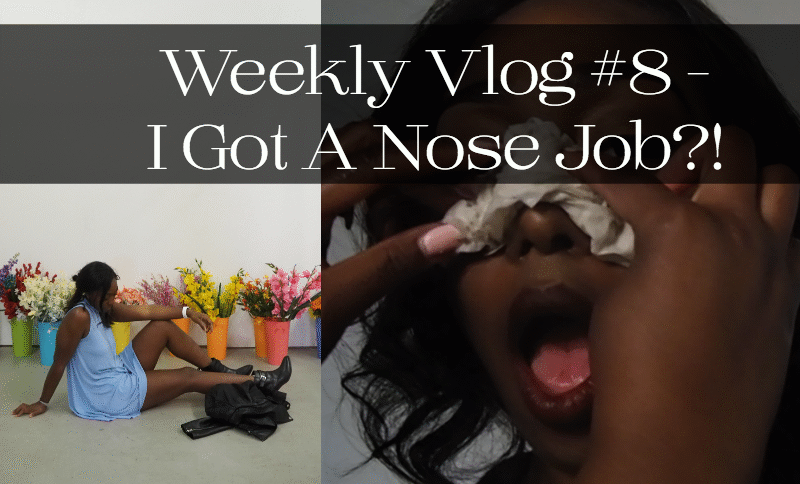 Jordan Taylor C - Weekly Vlog #8 - I Got A Nose Job?!