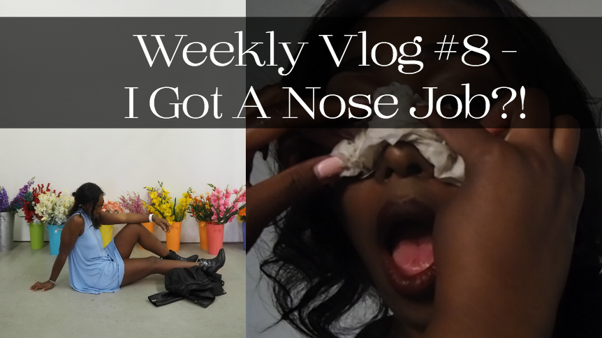 Jordan Taylor C - Weekly Vlog #8 - I Got A Nose Job?!